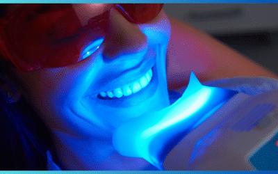 Sbiancamento dentale: miti, verità e consigli per un sorriso brillante